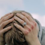 a man with bruised knuckles having a headache