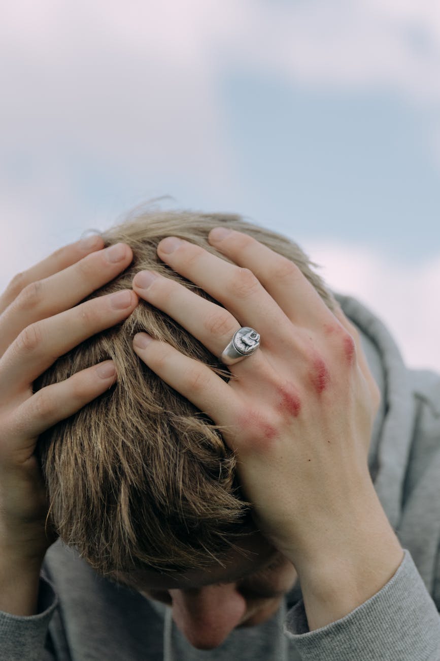 a man with bruised knuckles having a headache